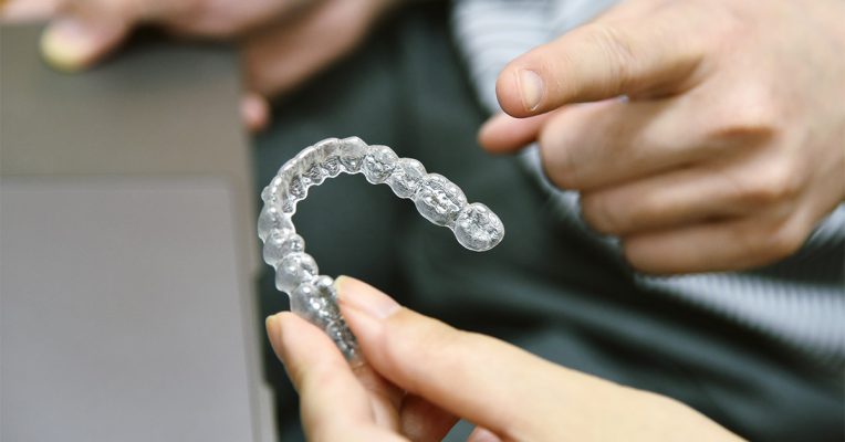 Γκανά Χειρουργός οδοντίατρος Ψυχικό Οδηγίες σε ασθενείς υπό ορθοδοντική θεραπεία χωρίς σιδεράκια